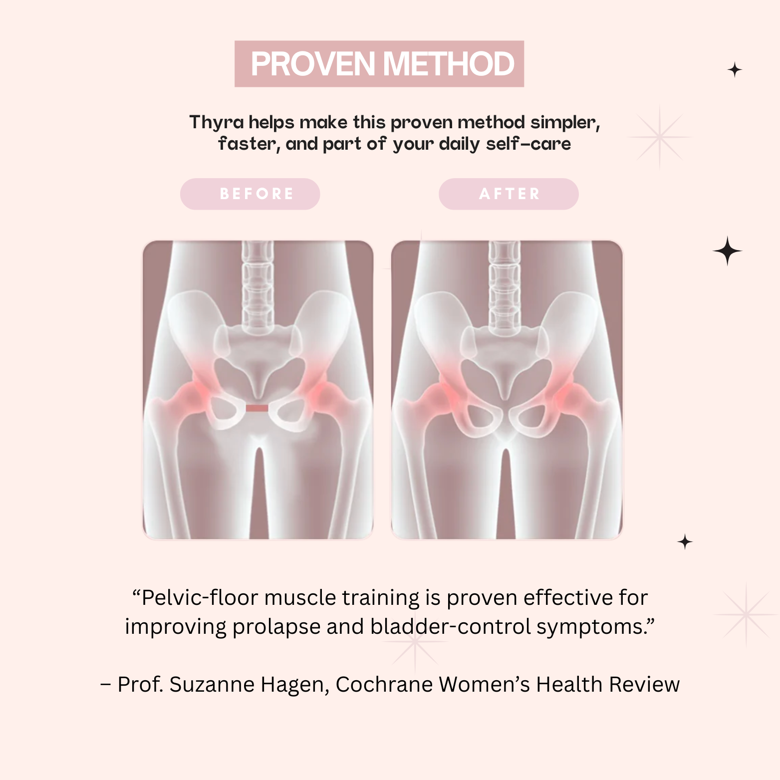 Thyra™ Pro 2 Trainer